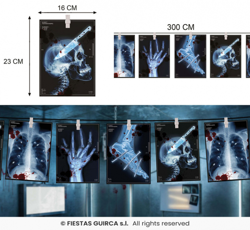 X-ray röntgenbilder
